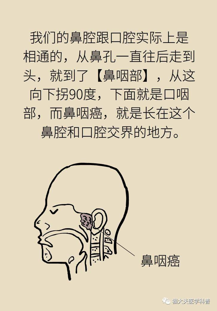 et|他因鼻咽癌去世——这种病为何更偏爱中国男人？