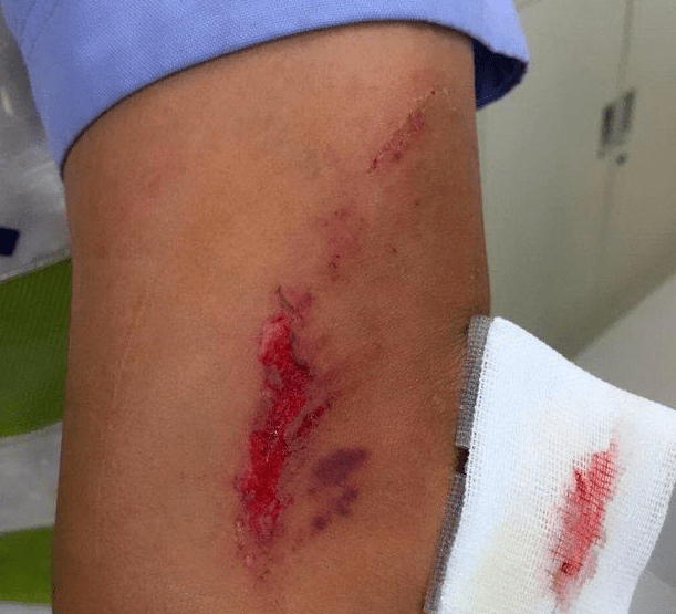 疱疹怎么快速处理 802df099fb4d46f4af24902f189cb60c.png