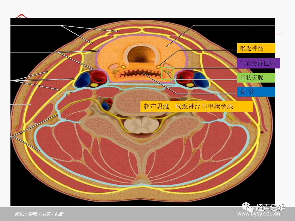纵切面左侧喉返神经和甲状腺下动脉位于甲状腺和食管之间,右侧位于