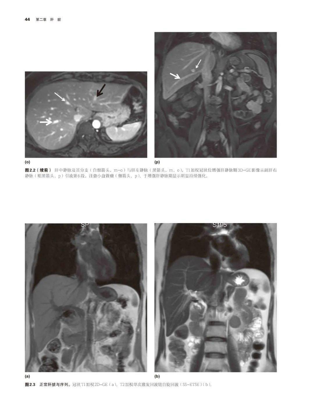腹膜后与腹壁 第十一章 膀胱与生殖系以外的盆腔 第十二章 男性盆腔