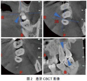 成语什么颌珠_成语故事简笔画(2)