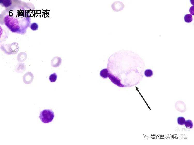 看图识细胞(第88期)_形态