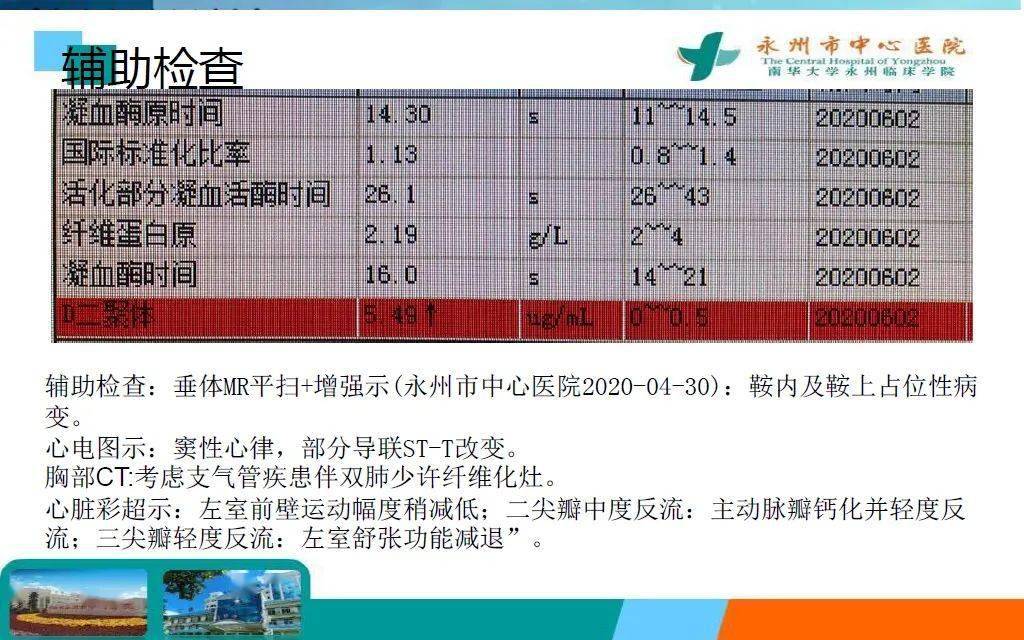 患者|病例分享 | 术中凝血功能障碍一例