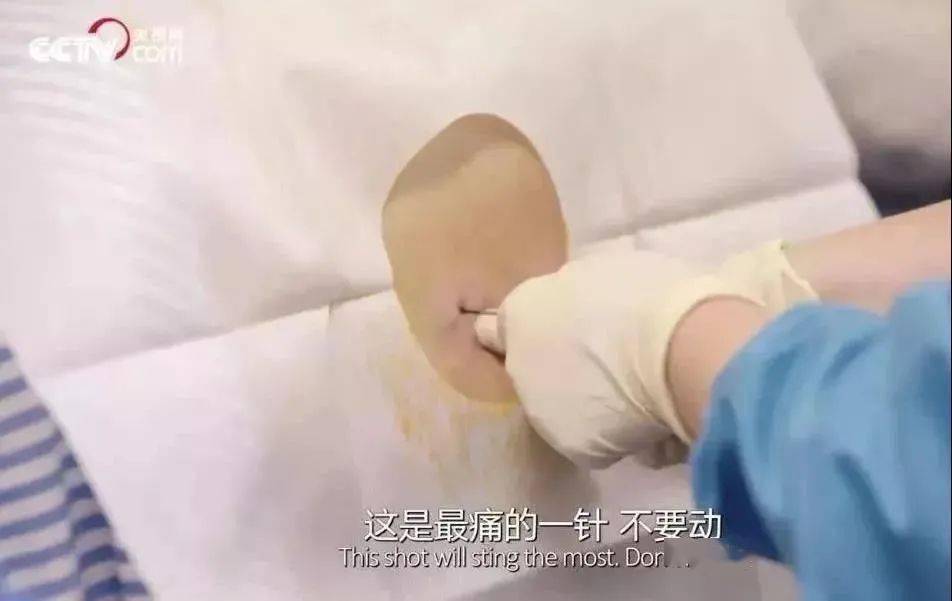 应采儿二胎剖腹产过程曝光:永远不要低估一个生孩子的
