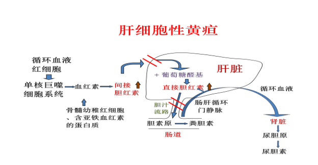 科普创新月巩膜皮肤发黄是不是得了黄疸