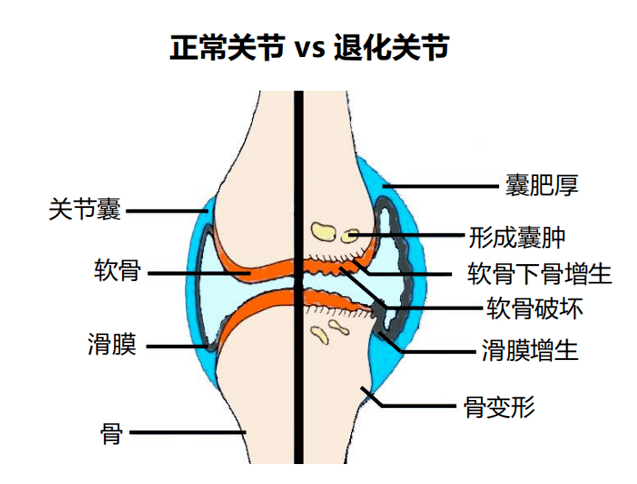 运动时膝关节咔咔响,还能跑步吗?其实真相很简单!