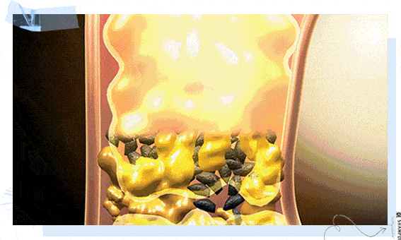 克兰|头上抠下的“白泥”，居然不是头皮屑？脱发头油都是因为它？