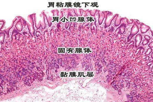 胃炎,肠化…离胃癌有多远?教你快速读懂胃镜报告