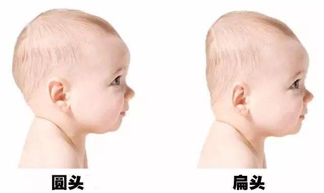 发型|天生扁头,各种发型丑哭了怎么办?教你一招,彻底摆脱发型困扰!