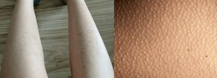 皮肤|雅顿身体乳涂一次，清爽一整天，让皮肤比丝绸还滑！全身亮成聚光灯！