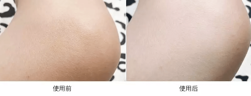 皮肤|雅顿身体乳涂一次，清爽一整天，让皮肤比丝绸还滑！全身亮成聚光灯！