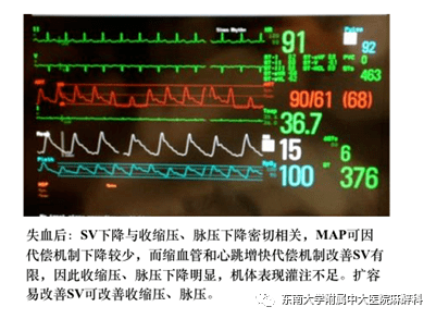 心输出量,平均动脉压和收缩压