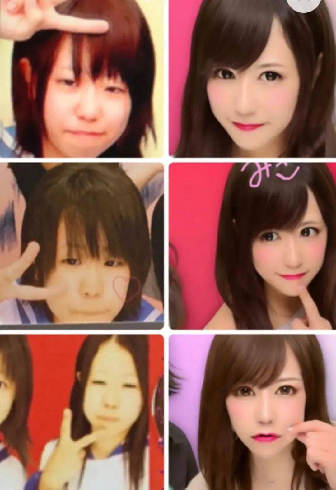 太丑|因被diss“太丑”花400万整容，宅女逆袭成新垣结衣？