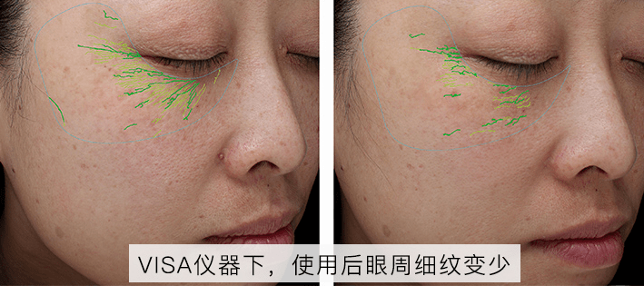 肌肤|嫩到掐出水！用一次比敷100片面膜还白润，10分钟感受女星同款水光肌！