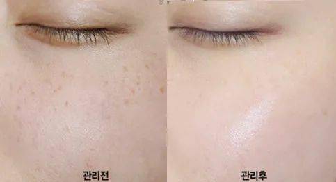 小土|黑黄皮逆袭！IU从“小土妹”到“白雪公主”，靠的竟然是它？！