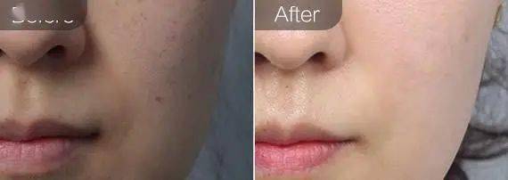 小土|黑黄皮逆袭！IU从“小土妹”到“白雪公主”，靠的竟然是它？！