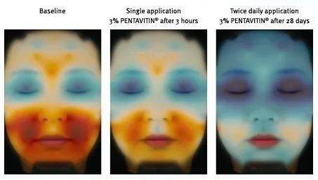 护肤品|扒皮？大牌护肤品竟然也加这些“便宜货”？！