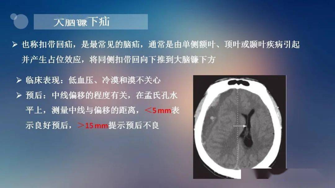 神经必备脑疝的类型及其影像学特征