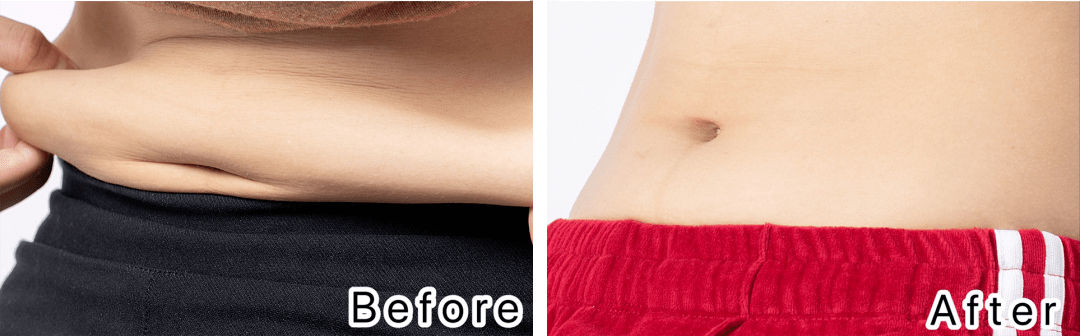 女明星|女明星的小蛮腰神器，足不出户也能瘦！