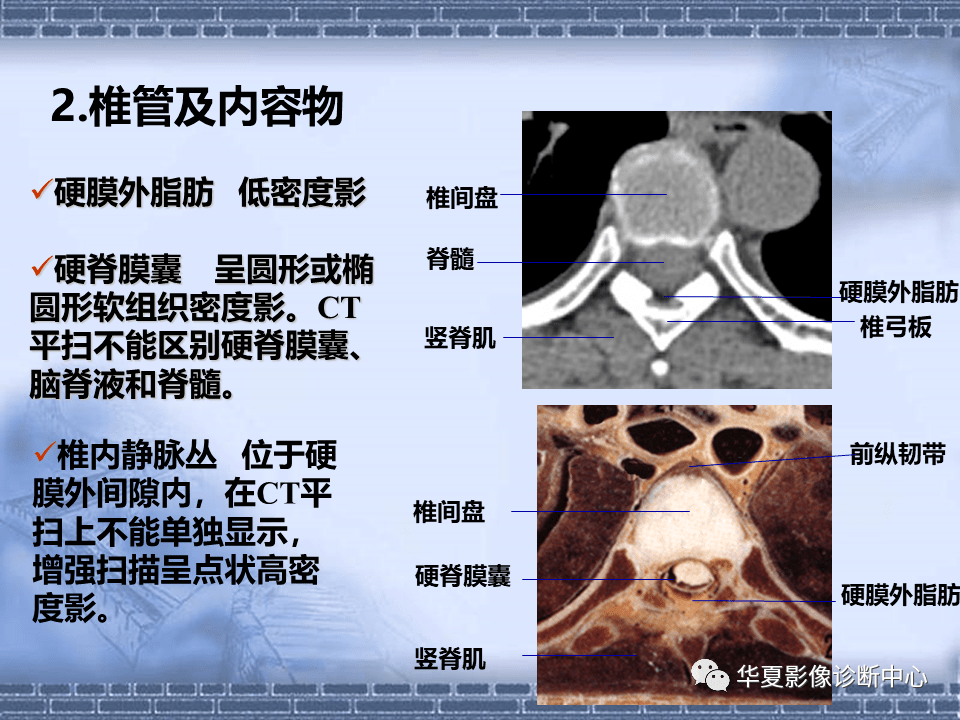 颈椎,腰椎ct常见病变