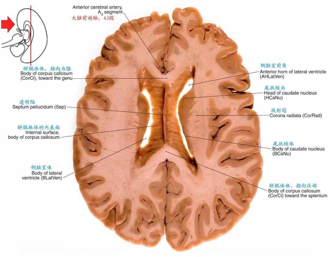解剖| 颅脑断层解剖图谱~标注到位,值得收藏