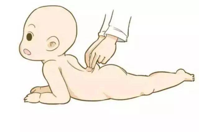 孩子|做不对小心伤了宝宝！【儿推篇】小儿推捏脊谨防误区
