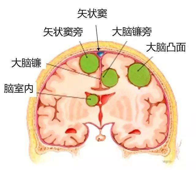 嗅神经损伤怎么办