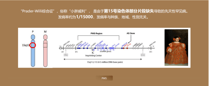 威利|目前尚无法治愈，还极易误诊|小胖威利关爱日1/15000发病率的儿童罕见病