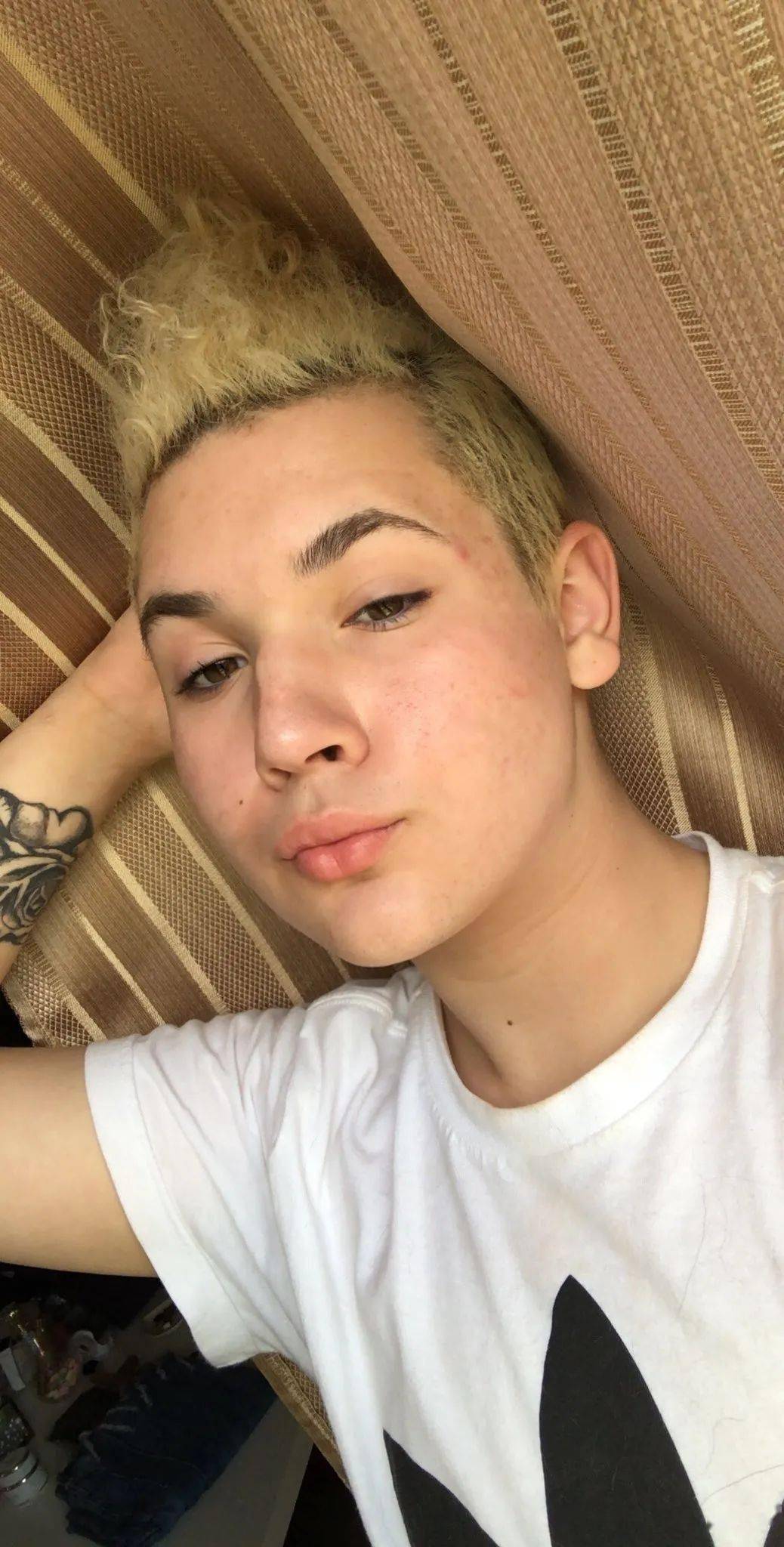 18岁男孩成功受孕（Mikey Chanel）