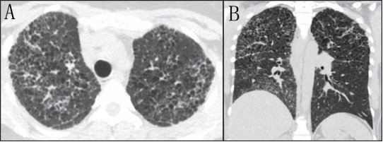 �����Է����Բ���ļ������