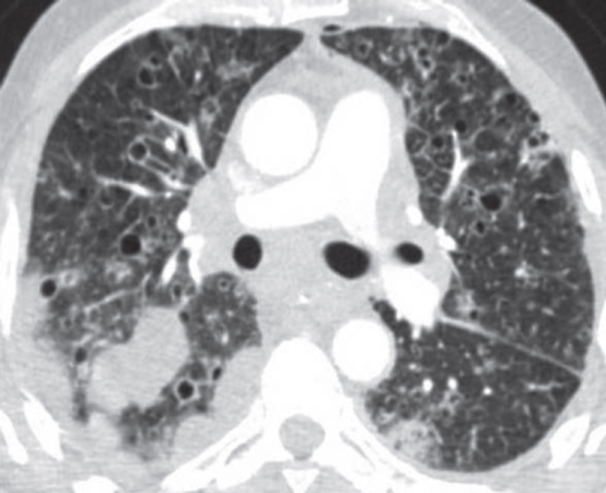 �����Է����Բ���ļ������