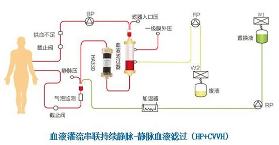 血液透析在整个治疗过程当中,只能够清除患者体内的小分子毒素和少