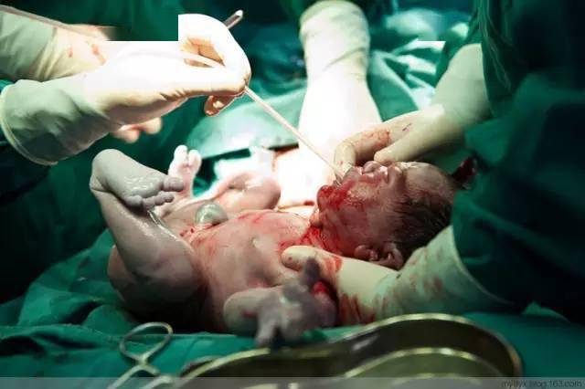 男生肚子照片真实 b457cd3c9a2d4196a249e79f52ba44ea.jpeg