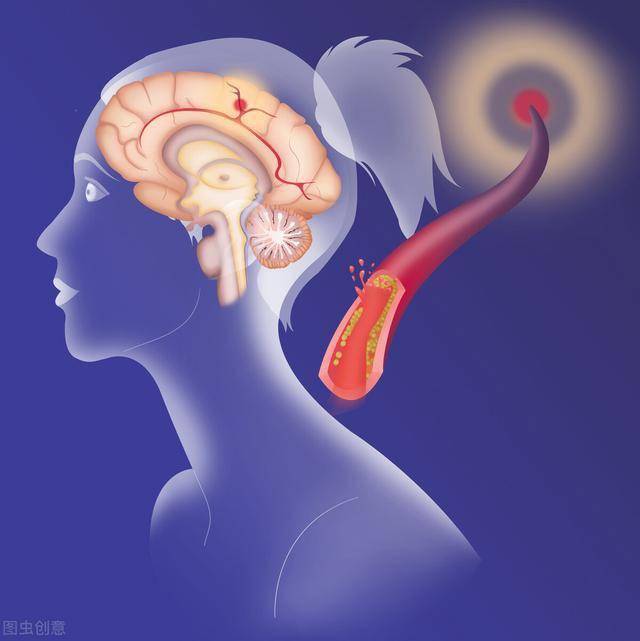 如何降低同型半胱氨酸值 c2f7a33a64b24a99a7c4e1e2f673fff7.jpeg