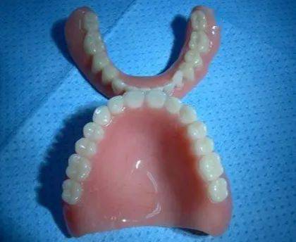 利用人工牙和基托来修复上下颌缺失的天然牙和黏膜组织的修复方法