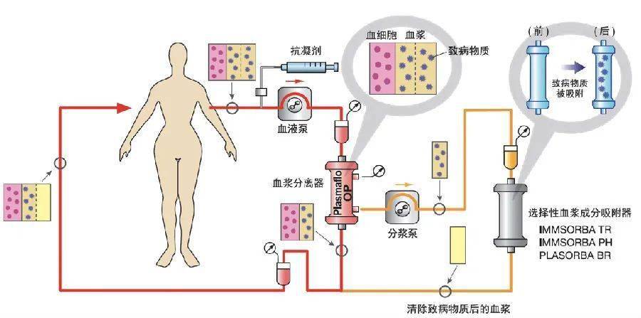 吸附层析的原理是什么_胡萝卜素吸附层析图片