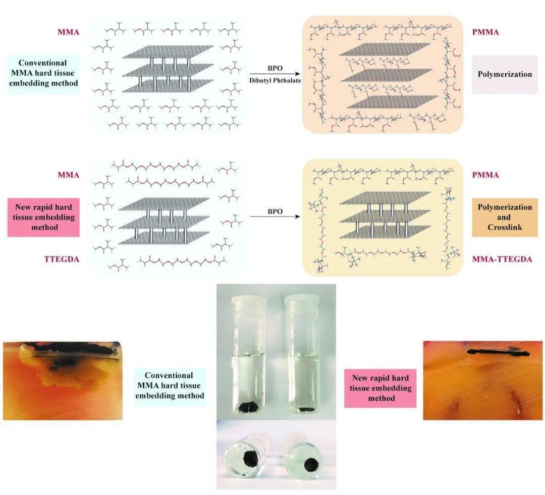 mme:新型快速硬组织包埋法应用于石墨烯纳米材料(多层石墨烯水凝胶)的