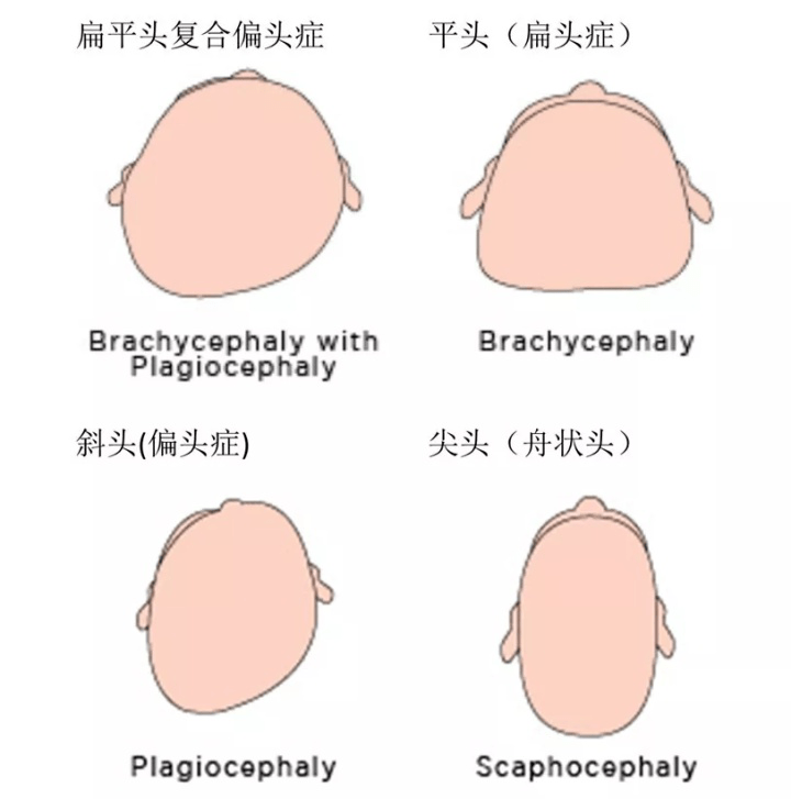 你有一颗奶奶辈引以为傲的头吗