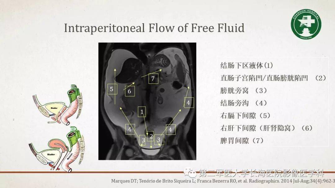 腹膜相关结构的影像解剖_肠系膜