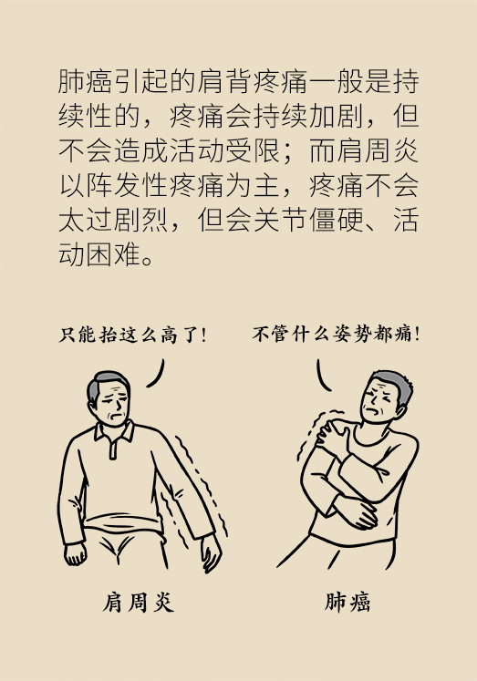 科普丨肩背疼痛久治不好别轻视,可能是肺癌