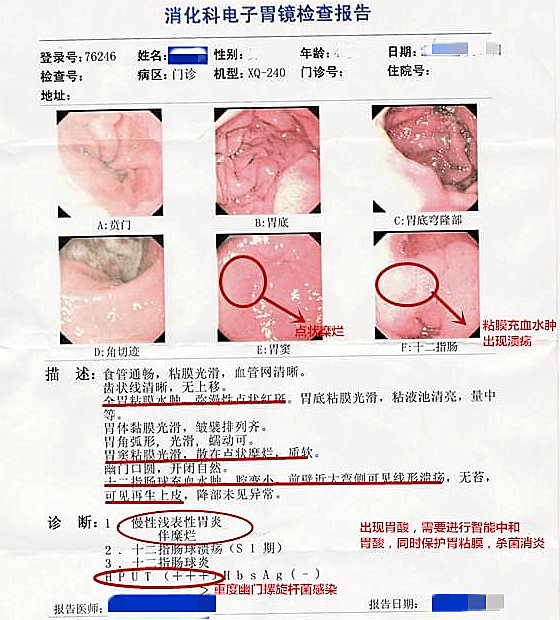 伊氏人口_伊氏锥虫图片(3)