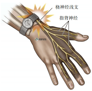 疼痛解剖学|手痛感觉异常_神经