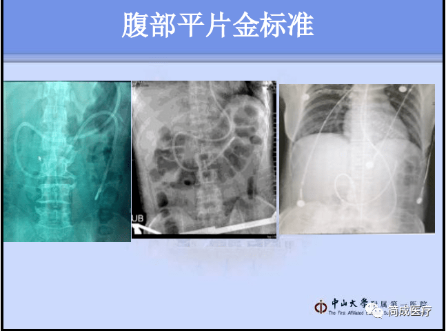 吃饭进到鼻子里怎么办