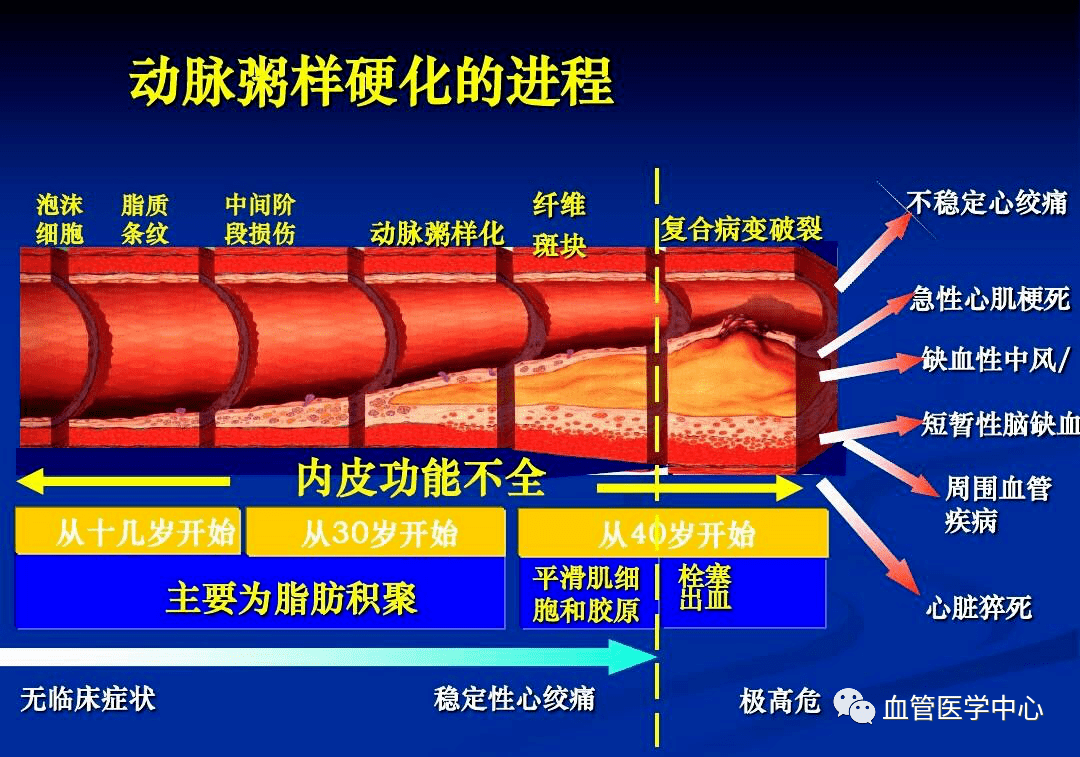 动脉粥样硬化斑块的形成是一个漫长的过程.