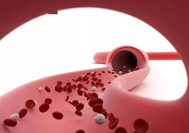 啥是软斑块 e7796660554e4c70abd80989485f39fd.jpeg