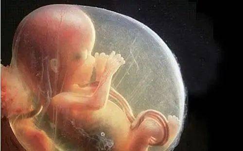 仅60天孕周的胎儿,药流后完整引出的模样看哭网友:真的太揪心了