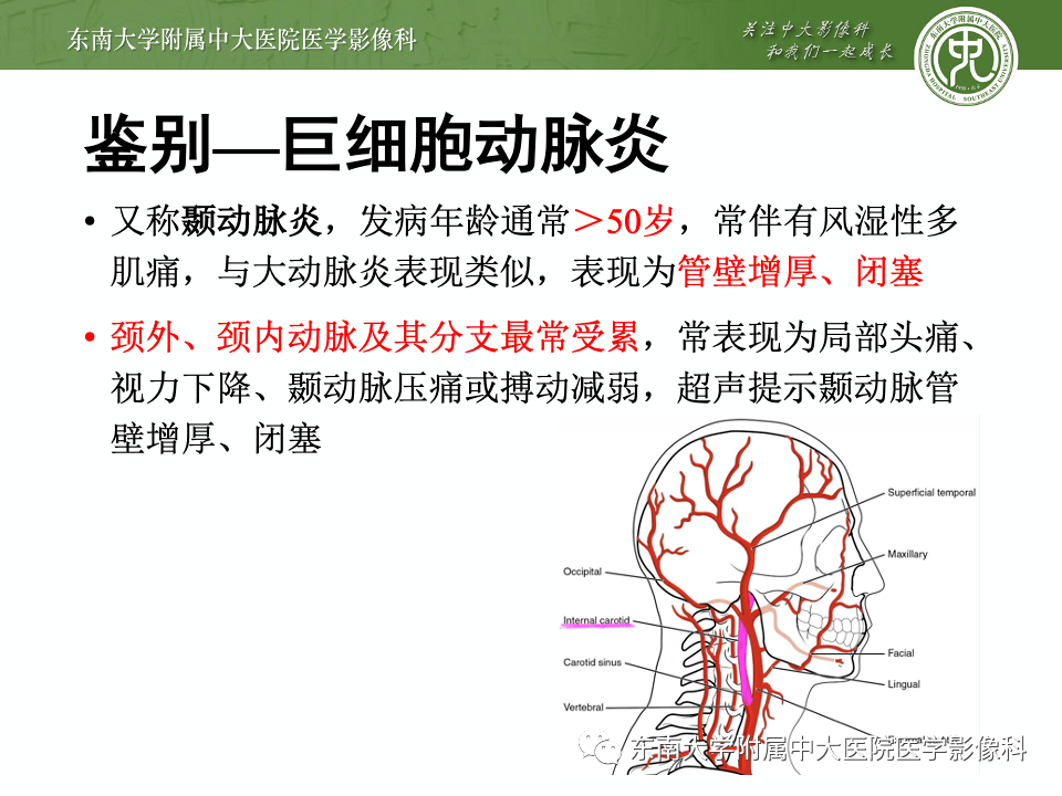 什么是循环系统疾病 2f27ed5ae14f44f187ffbbb8da444518.png