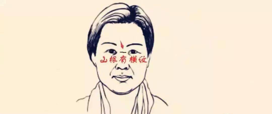 山根有横纹 来自搜狐网