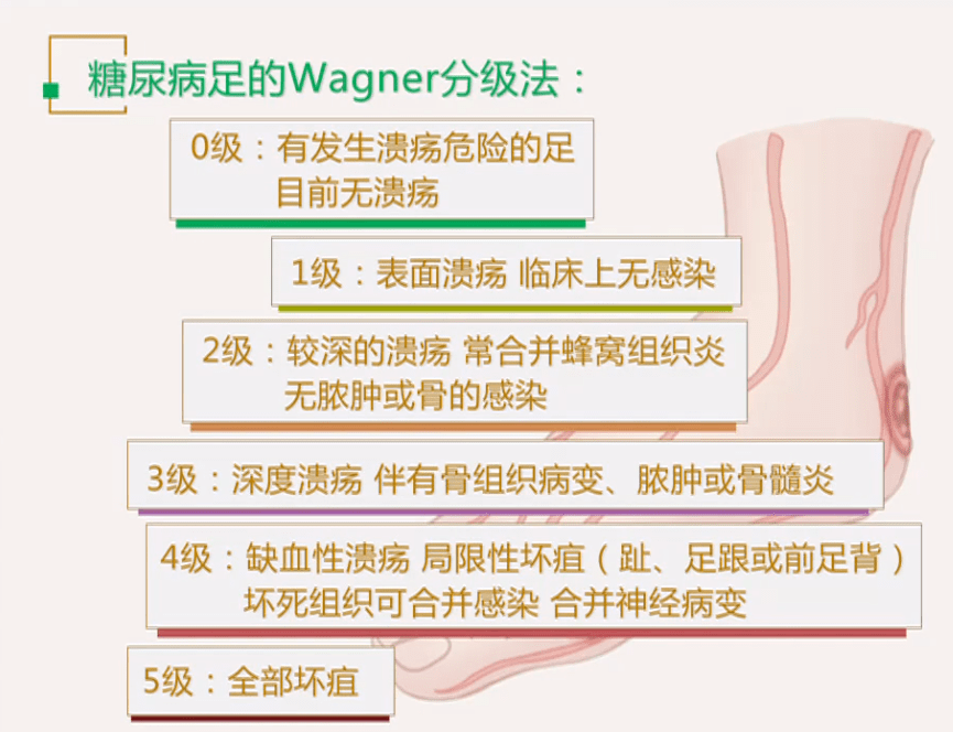 临床中,最常见的糖尿病足分级方法为wagner分级法.