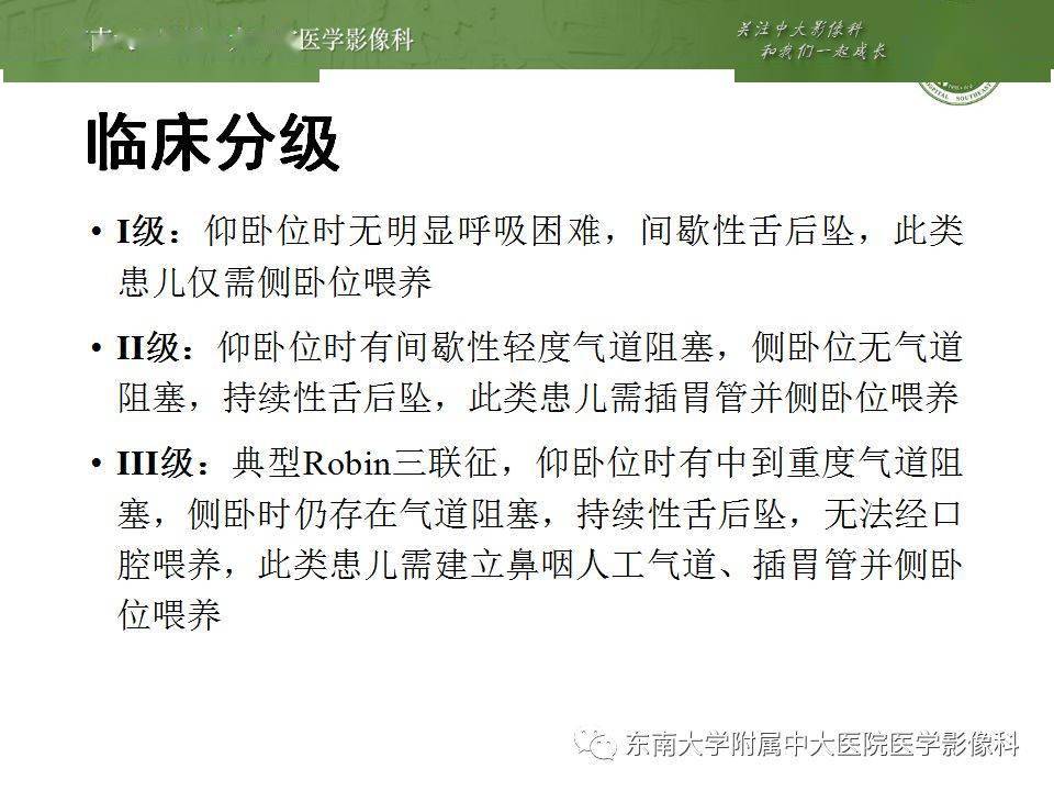 pierre robin综合征,klippel-feil综合征 头颈丨pierre-robin综合征